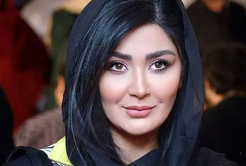 تغییر چهره مریم معصومی بعد از بازیگری اش