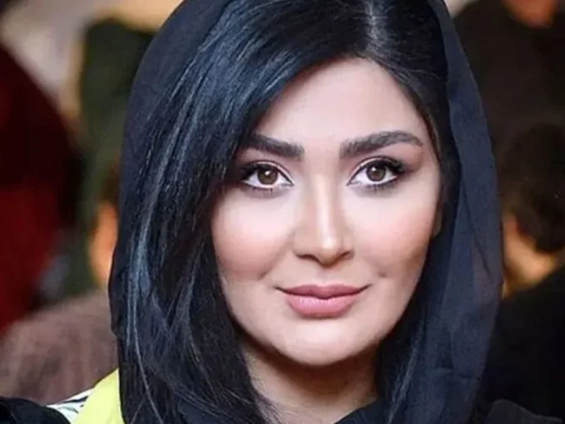 تغییر چهره مریم معصومی بعد از بازیگری اش