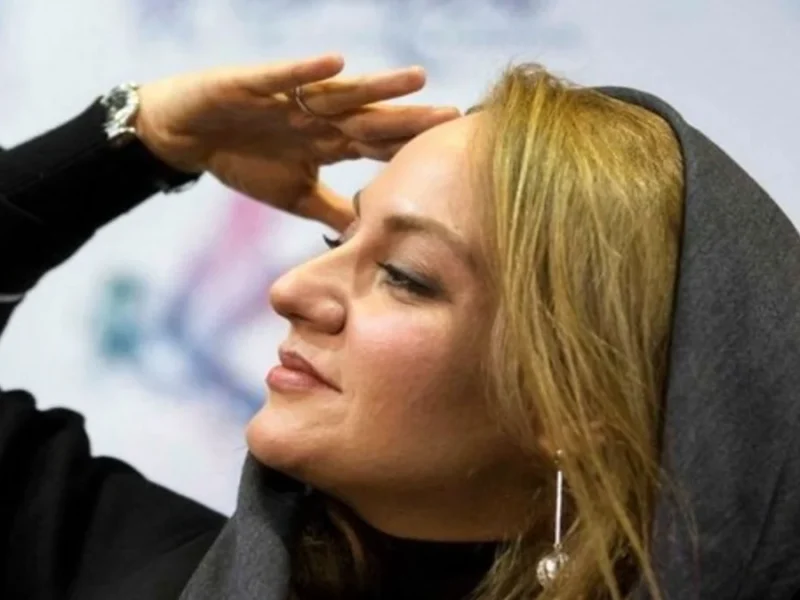 عکس از چهره متفاوت مهناز افشار در دوران بارداری