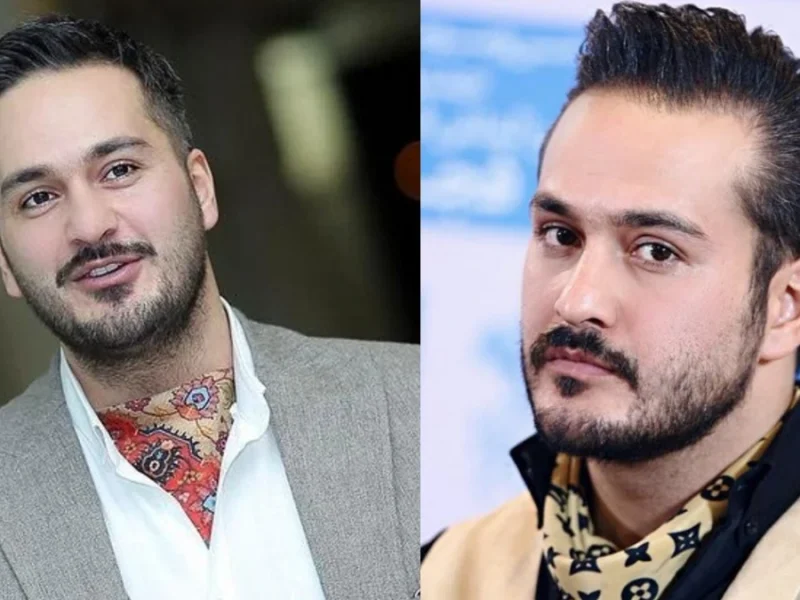 میلاد کی‌مرام با موهای سفید