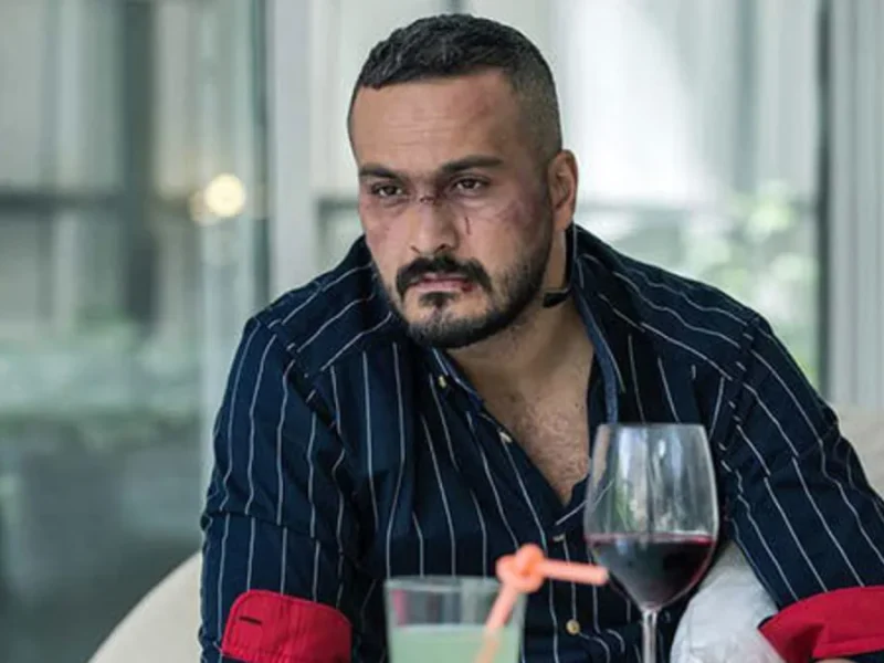 تغییر چهره شوکه کننده میلاد کی‌مرام بعد از سووشون