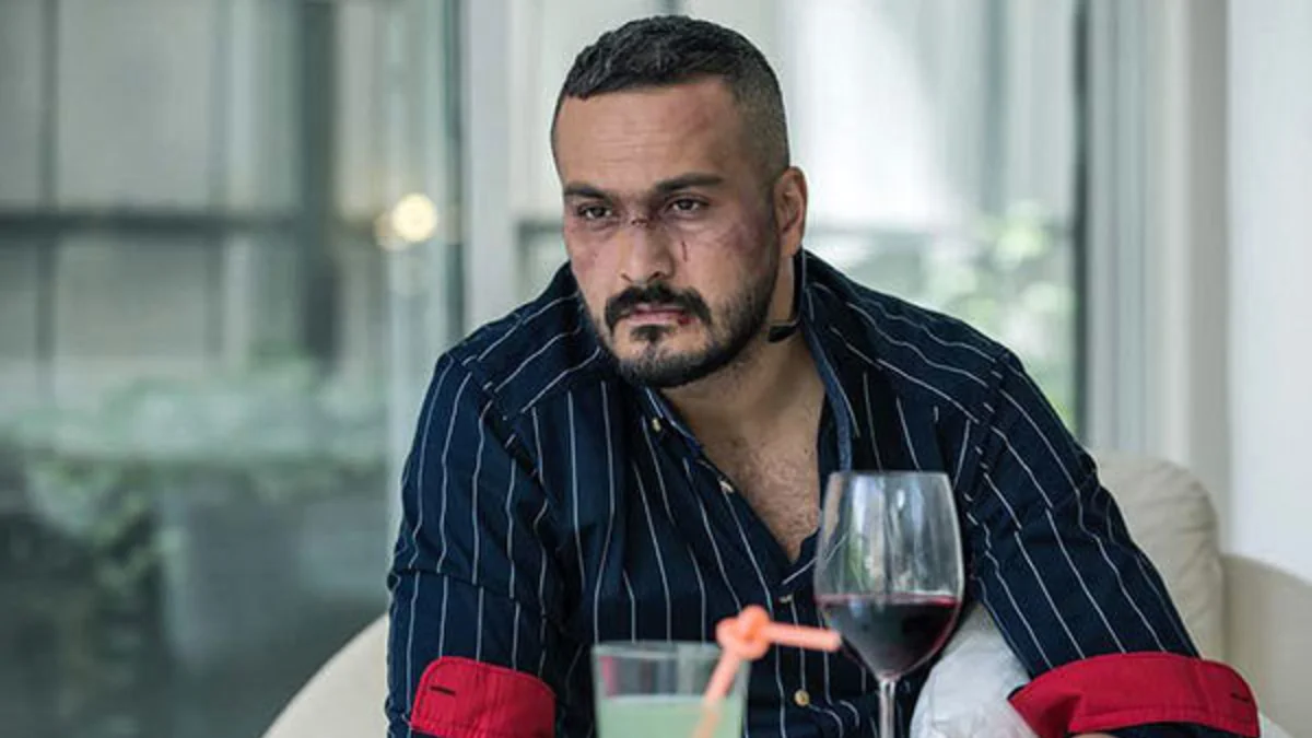 تغییر چهره شوکه کننده میلاد کی‌مرام بعد از سووشون