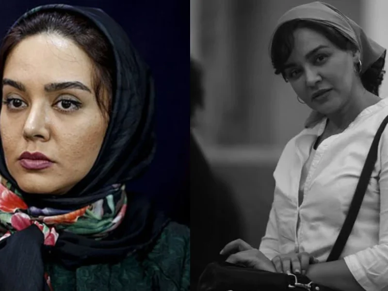 تصویر روز | چهره جدید ندا قاسمی بعد از جراحی زیبایی چهره جدید ندا قاسمی بعد از جراحی زیبایی