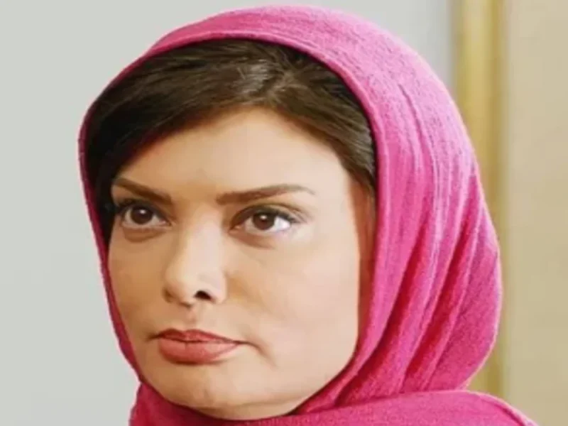 عکس های شوکه کننده نگار فروزنده بعد از عمل های زیبایی