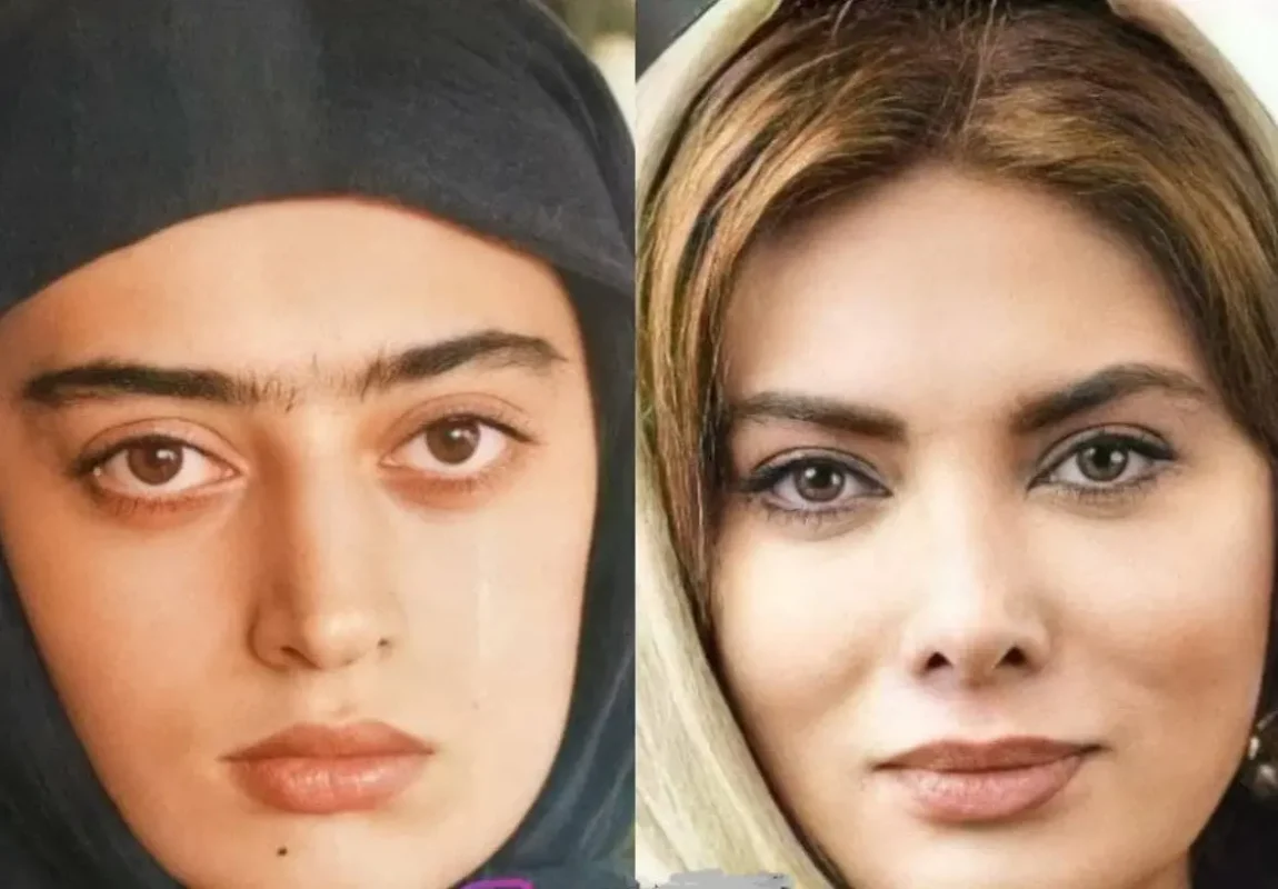 خبر روز | عکس های شوکه کننده نگار فروزنده بعد از عمل های زیبایی 5 نگارفروزنده3