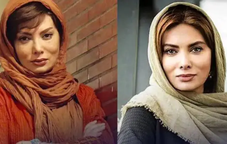 خبر روز | عکس های شوکه کننده نگار فروزنده بعد از عمل های زیبایی 2 نگارفروزنده6