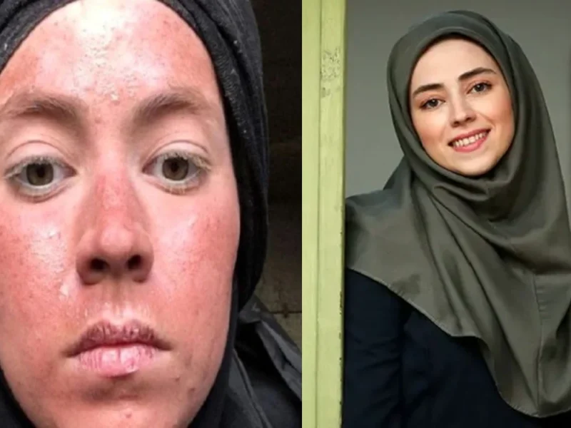تصویر روز | چهره نیلوفر رجایی فر در 32 سالگی چهره نیلوفر رجایی فردر 32 سالگی