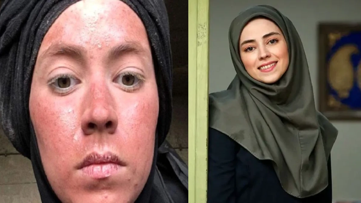 چهره نیلوفر رجایی فردر 32 سالگی