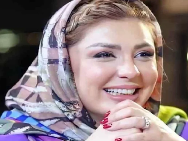 تصویر روز | نگاهی به چهره تغییر یافته نیوشا ضیغمی نگاهی به چهره تغییر یافته نیوشا ضیغمی