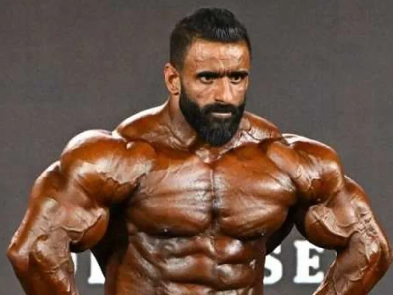 چهره هادی چوپان بعد از کاشت مو