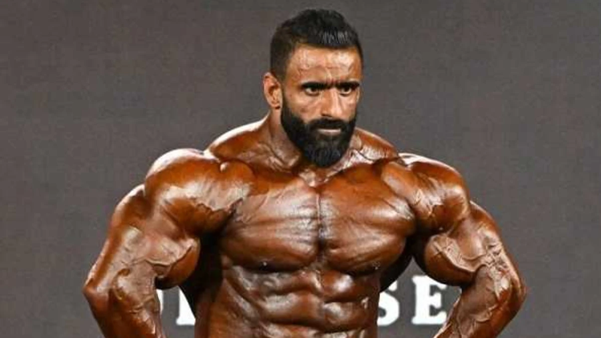 چهره هادی چوپان بعد از کاشت مو