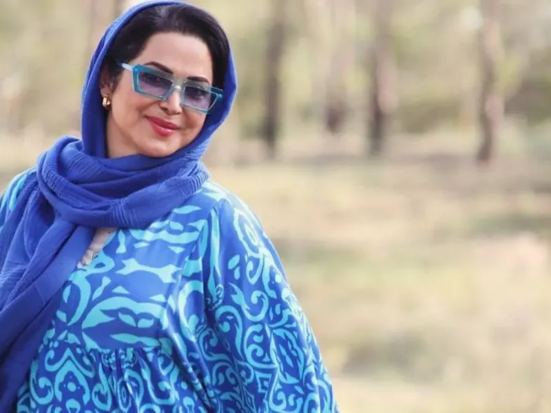 تغییر چهره جنجالی "کمند امیرسلیمانی" بعد از جراحی های زیبایی