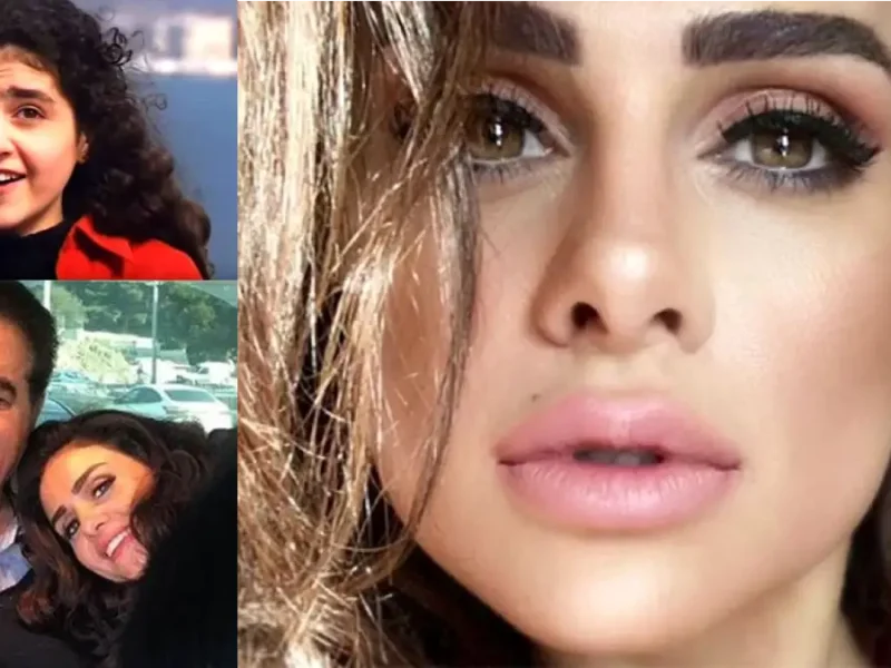 خبر روز | عکسهای شخصی و بیوگرافی گونل زینالوا خواننده ترک عکسهای شخصی و بیوگرافی گونل زینالوا خواننده ترک